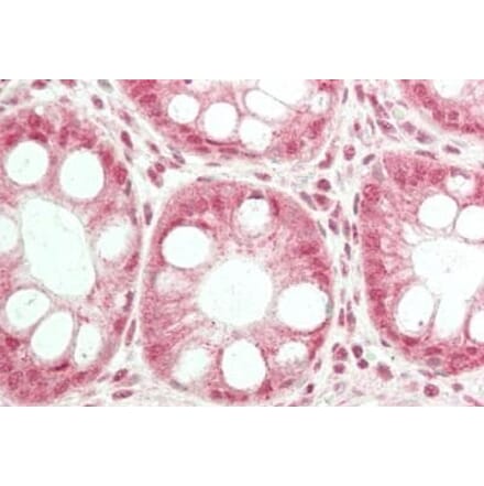 Immunohistochemistry - Anti-Trpc6 Antibody (A85037) - Antibodies.com