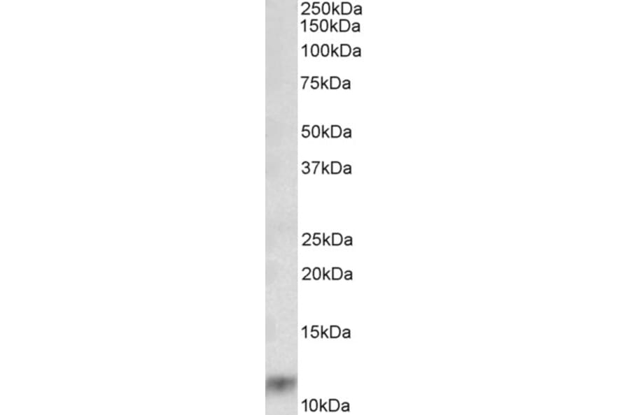 Western Blot - Anti-MRP8 Antibody (A85038) - Antibodies.com