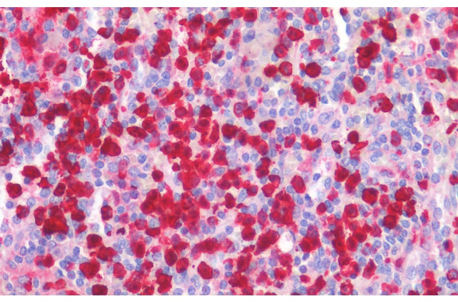 Immunohistochemistry - Anti-MRP8 Antibody (A85038) - Antibodies.com