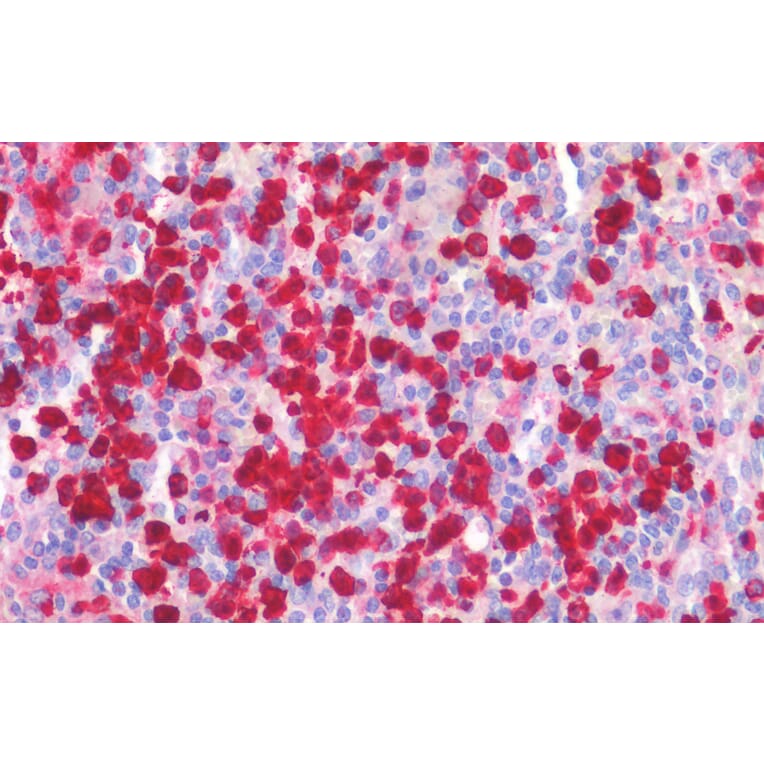 Immunohistochemistry - Anti-MRP8 Antibody (A85038) - Antibodies.com