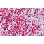 Immunohistochemistry - Anti-MRP8 Antibody (A85038) - Antibodies.com