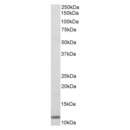 Western Blot - Anti-beta 2 Microglobulin Antibody (A85039) - Antibodies.com