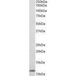 Western Blot - Anti-beta 2 Microglobulin Antibody (A85039) - Antibodies.com