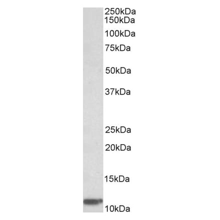 Western Blot - Anti-beta 2 Microglobulin Antibody (A85040) - Antibodies.com