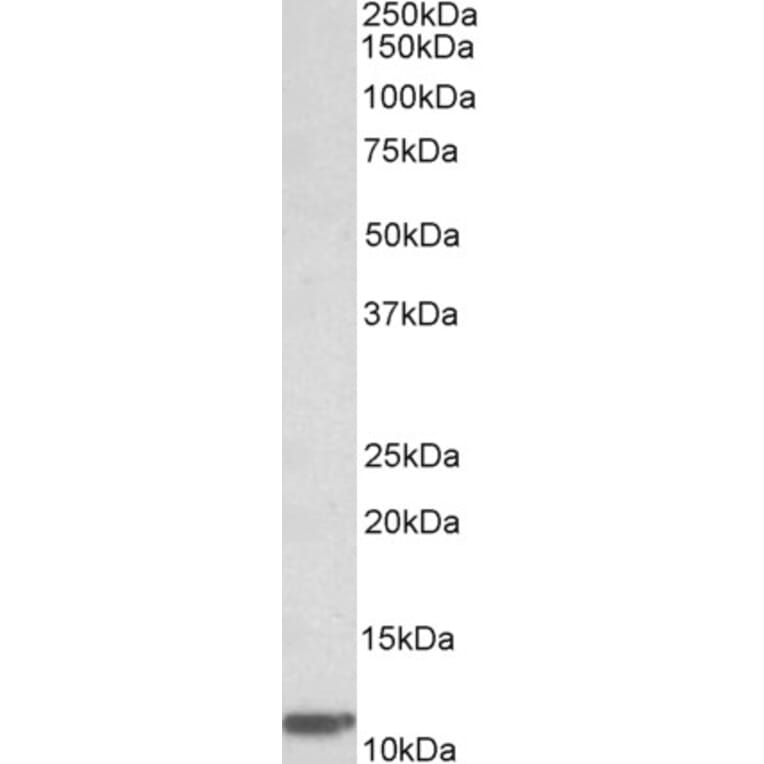 Western Blot - Anti-beta 2 Microglobulin Antibody (A85040) - Antibodies.com