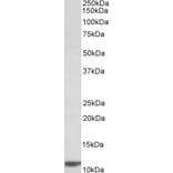 Western Blot - Anti-beta 2 Microglobulin Antibody (A85040) - Antibodies.com