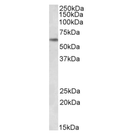 Western Blot - Anti-PLK1 Antibody (A85042) - Antibodies.com