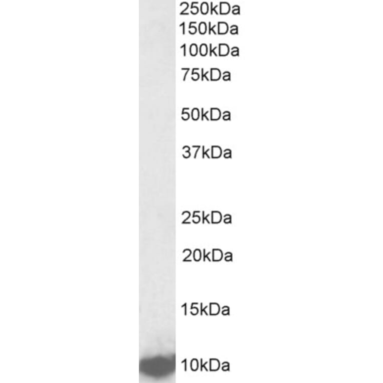 Western Blot - Anti-LSM2 Antibody (A85047) - Antibodies.com