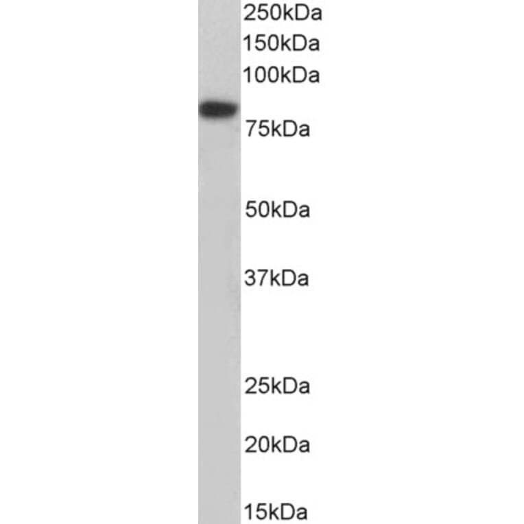 Western Blot - Anti-Coilin Antibody (A85048) - Antibodies.com