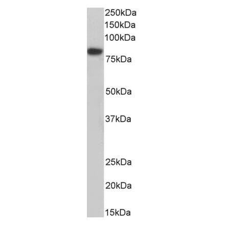 Western Blot - Anti-COIL Antibody (A85048) - Antibodies.com