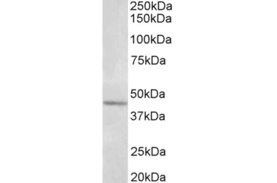 Western Blot - Anti-Synaptotagmin V Antibody (A85051) - Antibodies.com