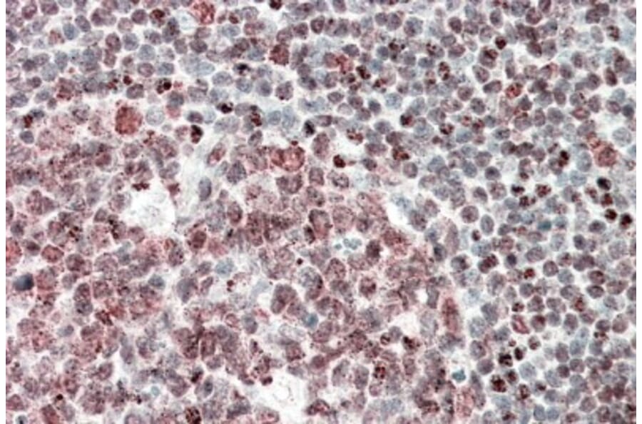 Immunohistochemistry - Anti-FUBP1/FBP Antibody (A85052) - Antibodies.com