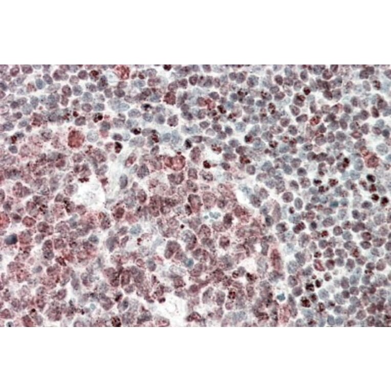 Immunohistochemistry - Anti-FUBP1/FBP Antibody (A85052) - Antibodies.com