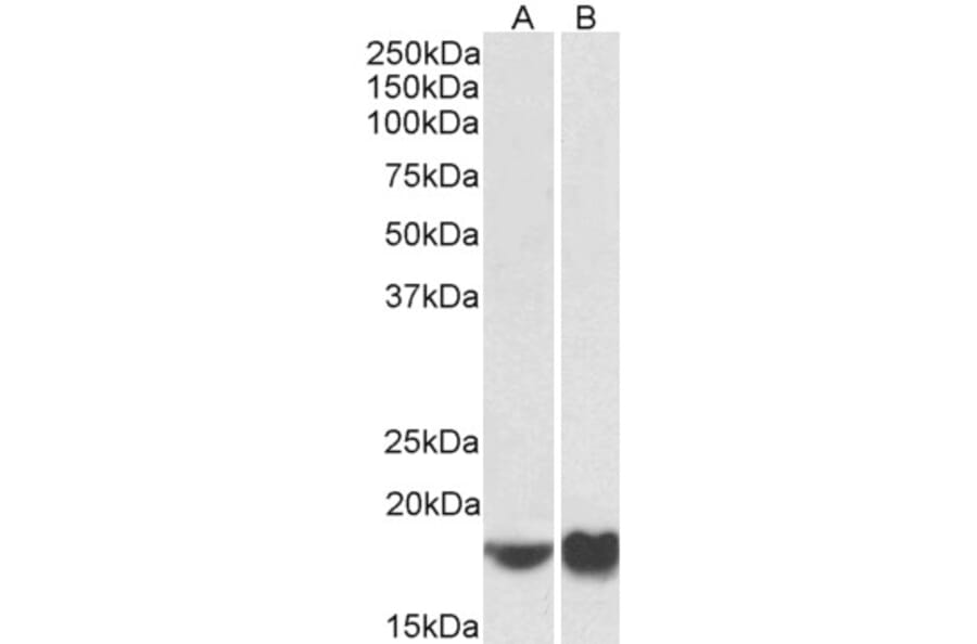 Western Blot - Anti-ARF4 Antibody (A85053) - Antibodies.com