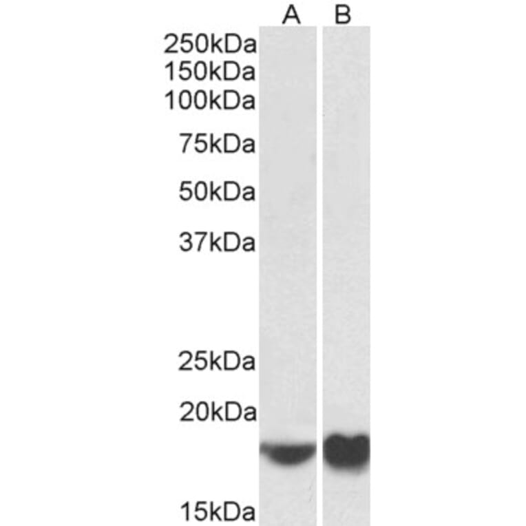 Western Blot - Anti-ARF4 Antibody (A85053) - Antibodies.com