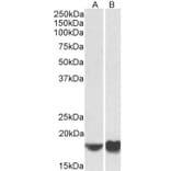 Western Blot - Anti-ARF4 Antibody (A85053) - Antibodies.com