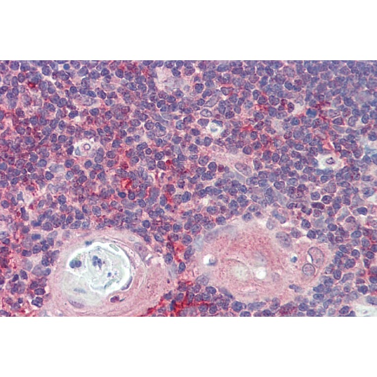 Immunohistochemistry - Anti-ARF4 Antibody (A85053) - Antibodies.com