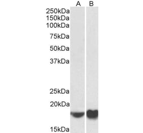 Western Blot - Anti-ARF4 Antibody (A85053) - Antibodies.com