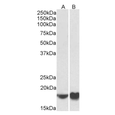 Western Blot - Anti-ARF4 Antibody (A85053) - Antibodies.com