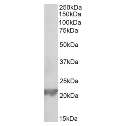 Western Blot - Anti-Gpx1 Antibody (A85058) - Antibodies.com