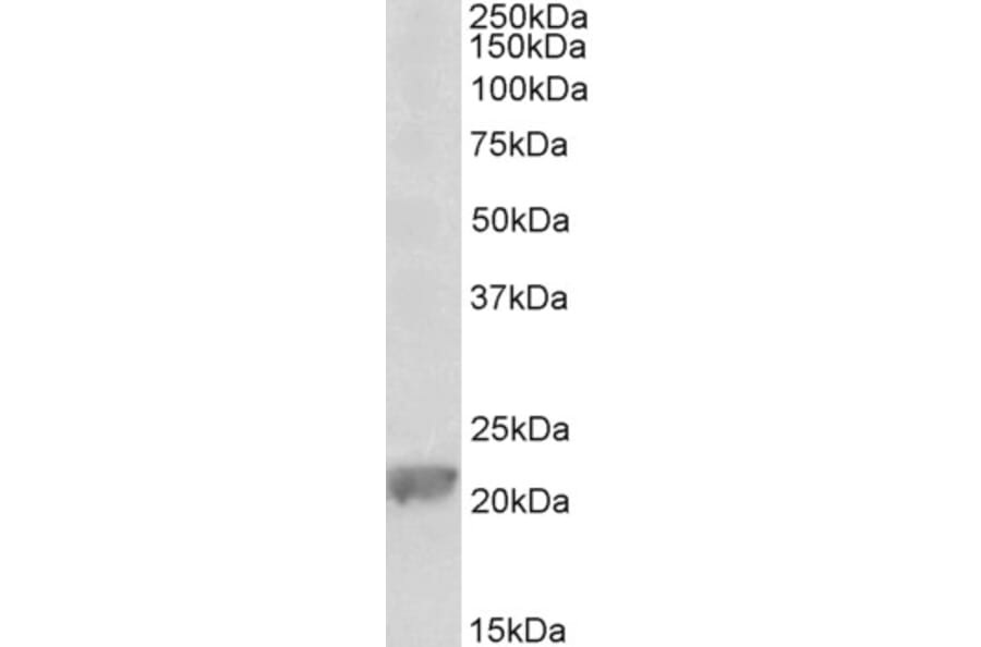 Western Blot - Anti-GPX1 (Glutathione Peroxidase 1) Antibody (A85059) - Antibodies.com