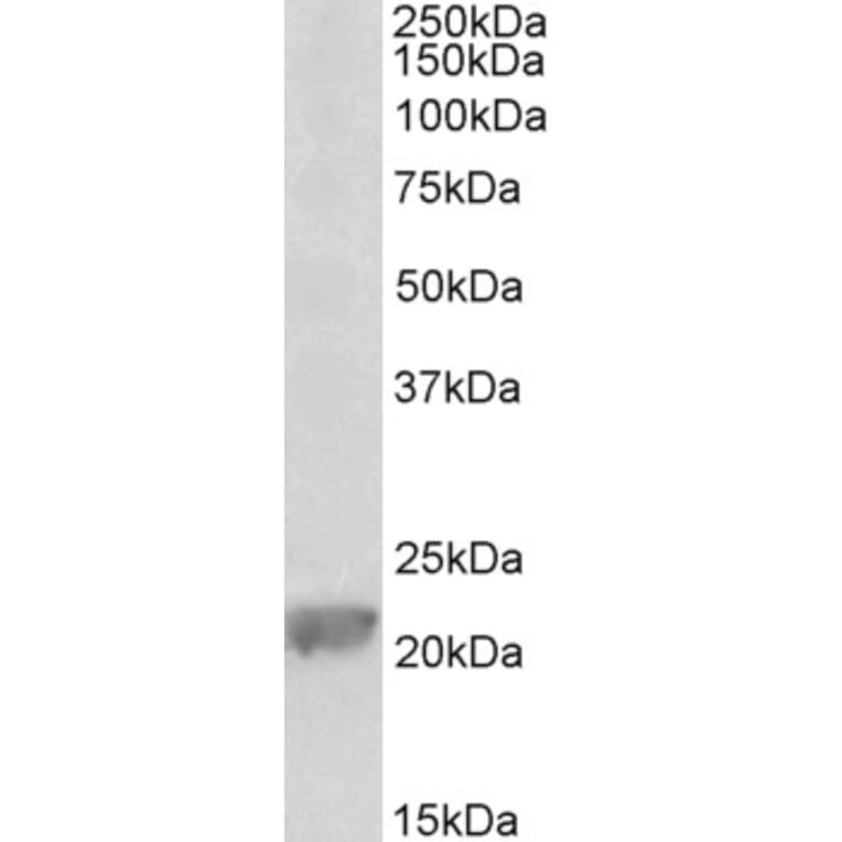 Western Blot - Anti-GPX1 (Glutathione Peroxidase 1) Antibody (A85059) - Antibodies.com