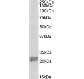 Western Blot - Anti-Gpx1 Antibody (A85059) - Antibodies.com
