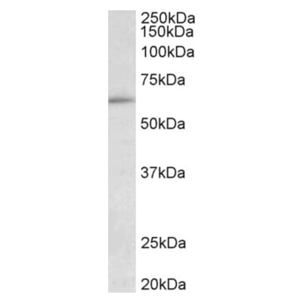 Western Blot - Anti-HIC2 Antibody (A85061) - Antibodies.com