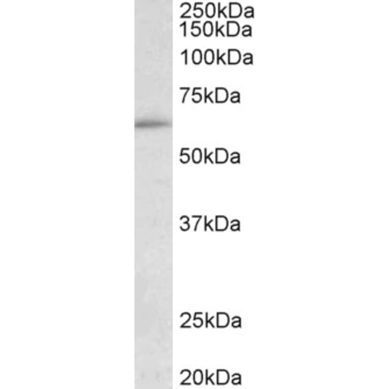 Western Blot - Anti-HIC2 Antibody (A85061) - Antibodies.com