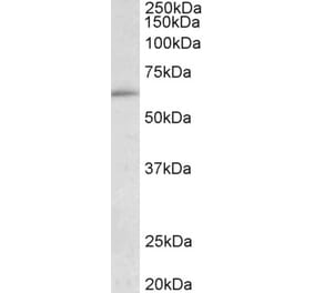 Western Blot - Anti-HIC2 Antibody (A85061) - Antibodies.com