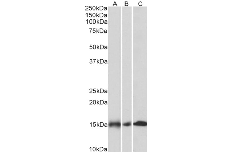 Western Blot - Anti-NDUFA7 Antibody (A85062) - Antibodies.com