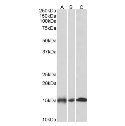 Western Blot - Anti-NDUFA7 Antibody (A85062) - Antibodies.com