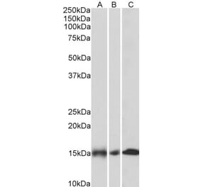 Western Blot - Anti-NDUFA7 Antibody (A85062) - Antibodies.com
