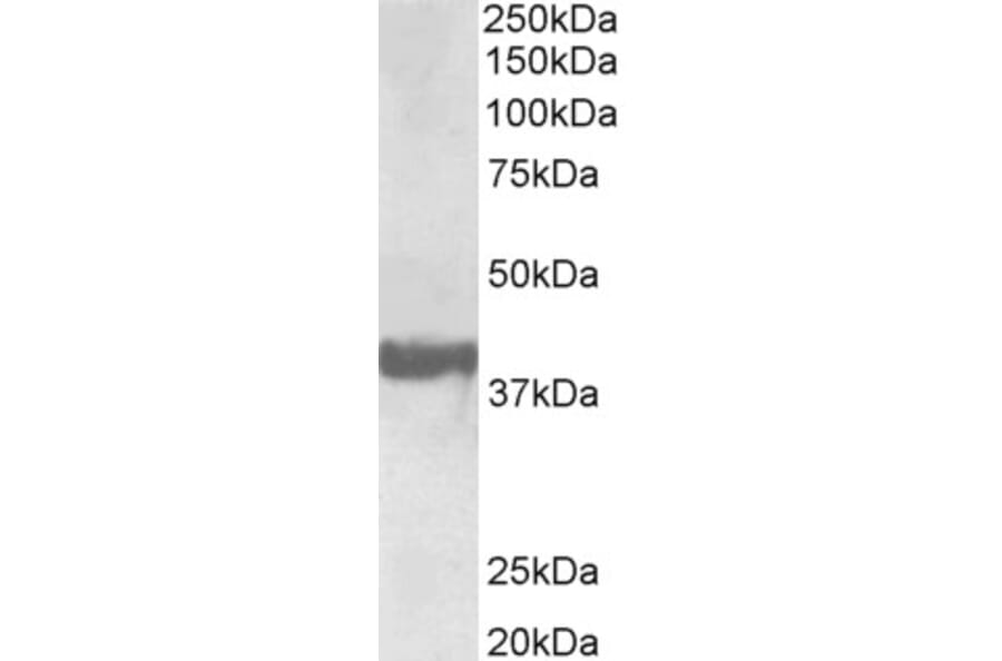 Western Blot - Anti-SH3GL2 Antibody (A85065) - Antibodies.com
