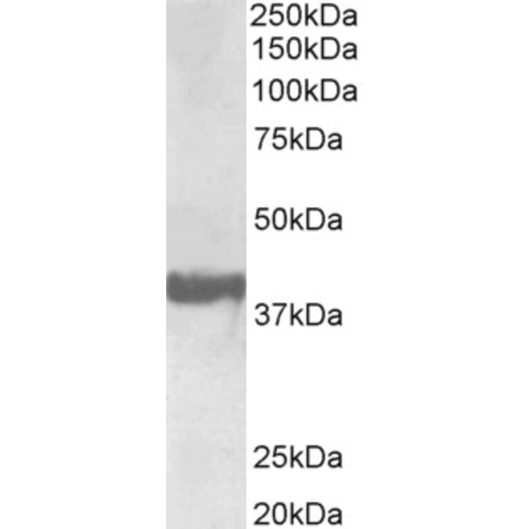 Western Blot - Anti-SH3GL2 Antibody (A85065) - Antibodies.com