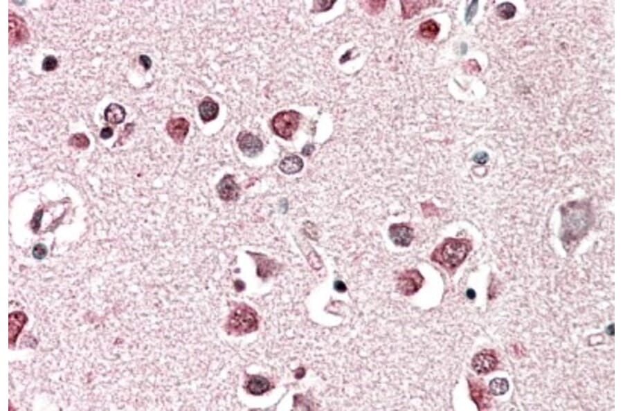 Immunohistochemistry - Anti-SH3GL2 Antibody (A85065) - Antibodies.com