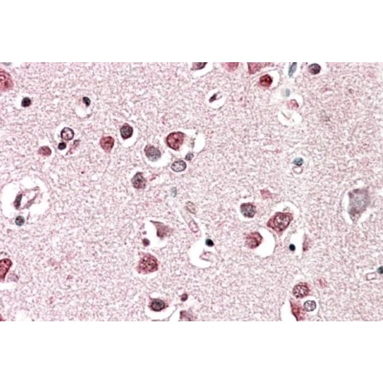 Immunohistochemistry - Anti-SH3GL2 Antibody (A85065) - Antibodies.com