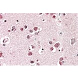 Immunohistochemistry - Anti-SH3GL2 Antibody (A85065) - Antibodies.com