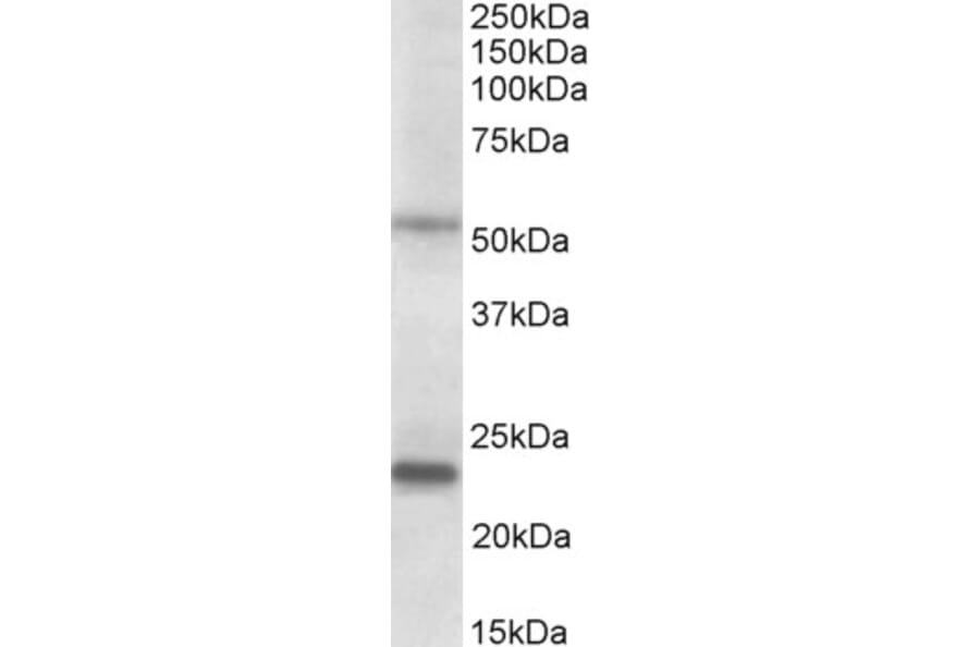 Western Blot - Anti-MMP3 Antibody (A85067) - Antibodies.com