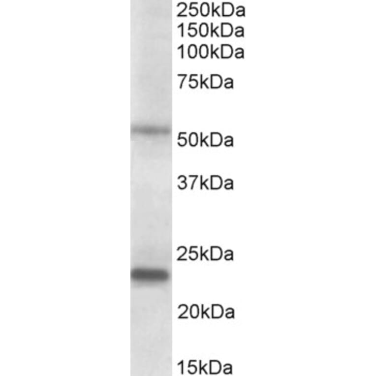 Western Blot - Anti-MMP3 Antibody (A85067) - Antibodies.com