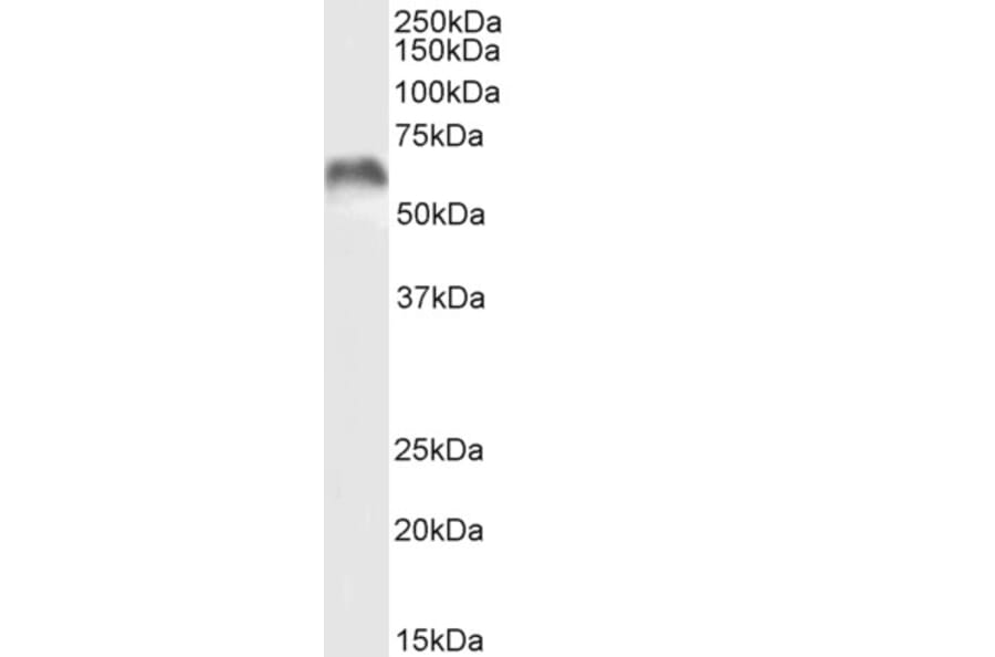 Western Blot - Anti-MMP3 Antibody (A85067) - Antibodies.com