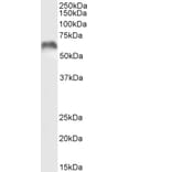 Western Blot - Anti-MMP3 Antibody (A85067) - Antibodies.com