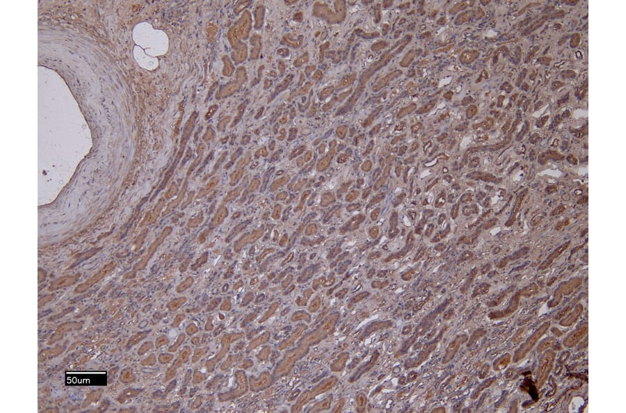 Immunohistochemistry - Anti-MMP3 Antibody (A85067) - Antibodies.com