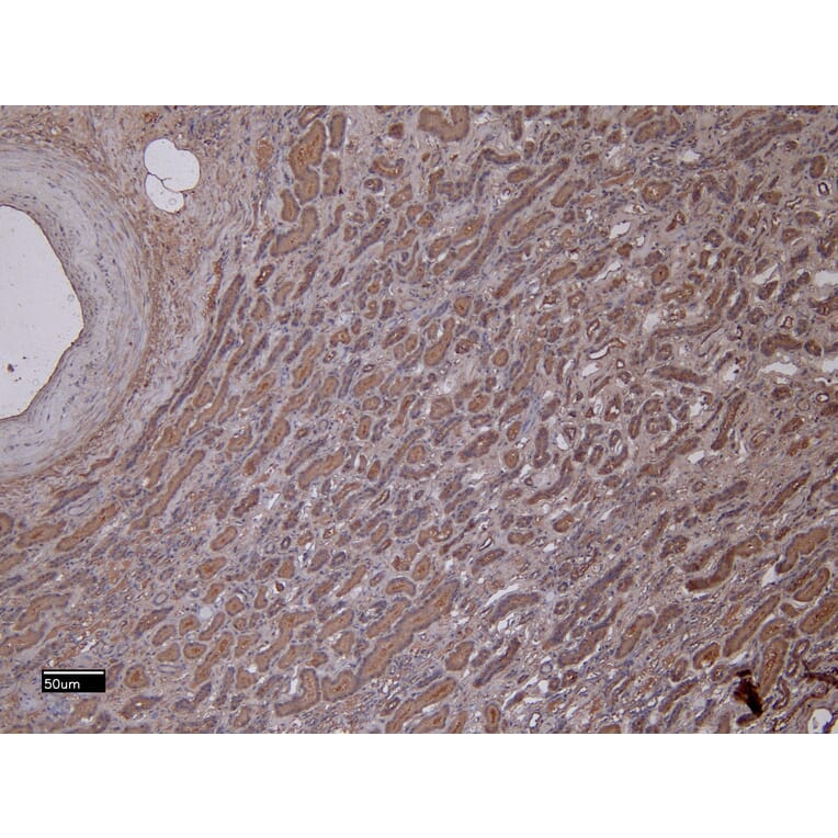 Immunohistochemistry - Anti-MMP3 Antibody (A85067) - Antibodies.com