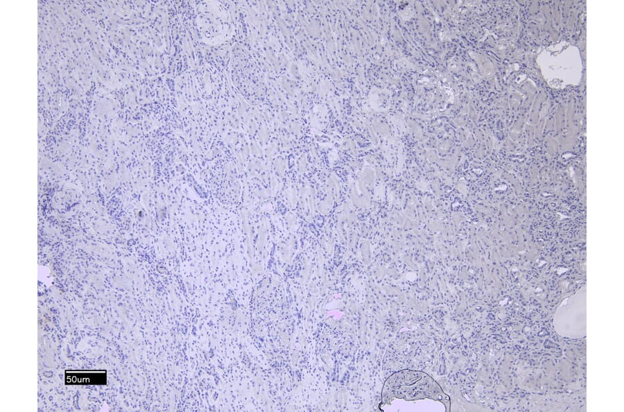 Immunohistochemistry - Anti-MMP3 Antibody (A85067) - Antibodies.com