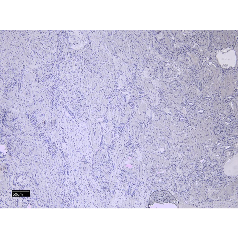 Immunohistochemistry - Anti-MMP3 Antibody (A85067) - Antibodies.com