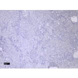 Immunohistochemistry - Anti-MMP3 Antibody (A85067) - Antibodies.com