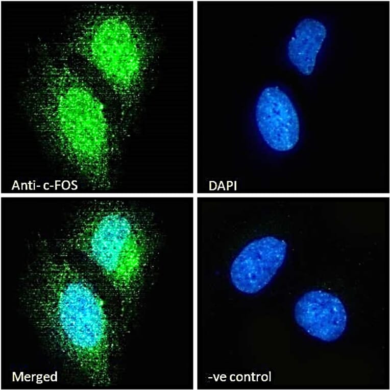 Immunofluorescence - Anti-c-Fos Antibody (A85069) - Antibodies.com