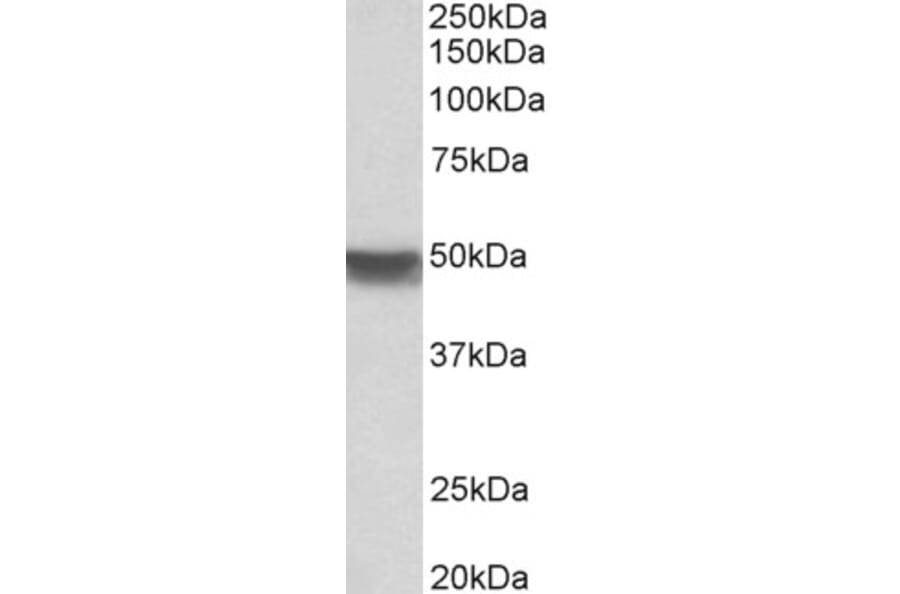 Western Blot - Anti-Cytokeratin 20 Antibody (A85071) - Antibodies.com