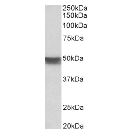Western Blot - Anti-Cytokeratin 20 Antibody (A85071) - Antibodies.com